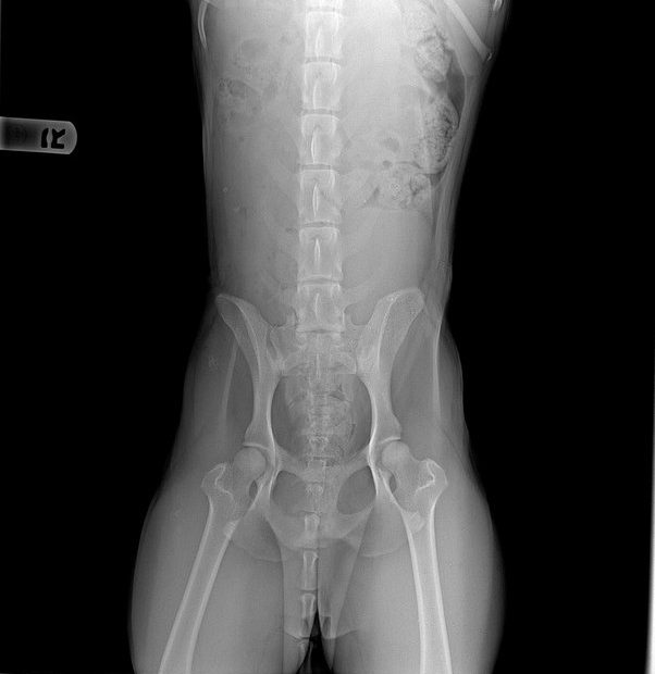 What Is The Average Cost Of X-Rays For A Dog? - Quora